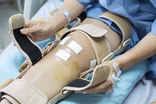 Lesión de ligamento cruzado