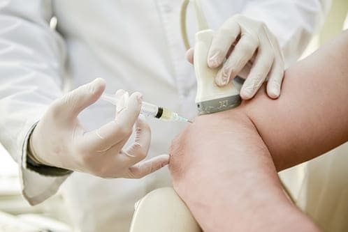 Infiltraciones o viscosuplementación